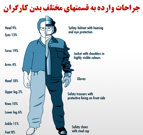  آسیب به اندامها در اثر حوادث کاری
